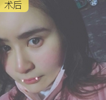 超级微拉美