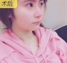 超级微拉美