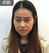 超级微拉美