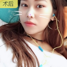超级微拉美