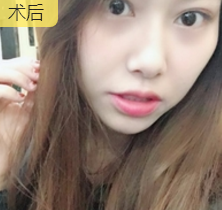 超级微拉美