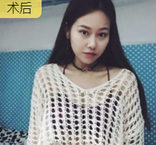 超级微拉美