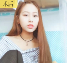 超级微拉美