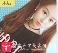 超级微拉美