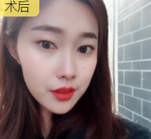 超级微拉美