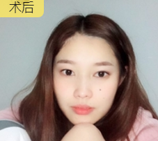 超级微拉美