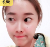 超级微拉美