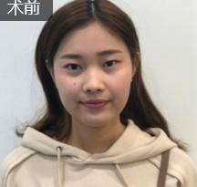超级微拉美