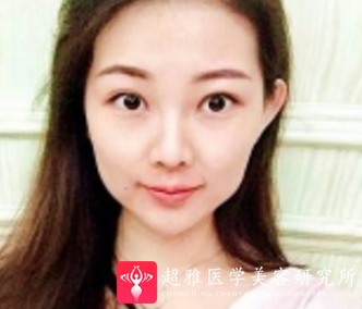 超级微拉美