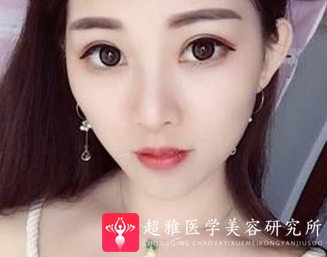 超级微拉美