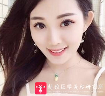 超级微拉美