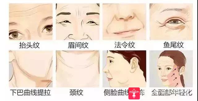 超级微拉美