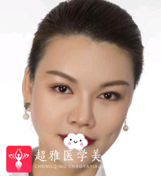 超声波瘦脸