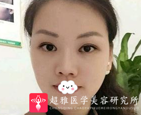 超声波瘦脸
