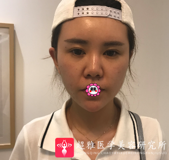 超级微拉美