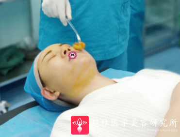 超级微拉美