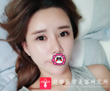 超级微拉美