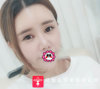 超级微拉美