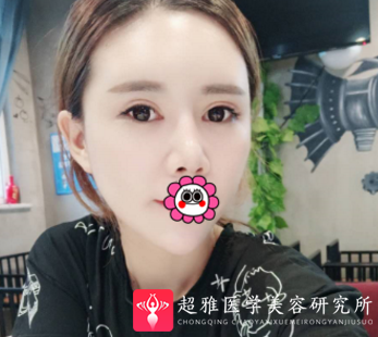 超级微拉美