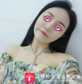 超级微拉美