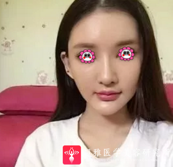 超级微拉美
