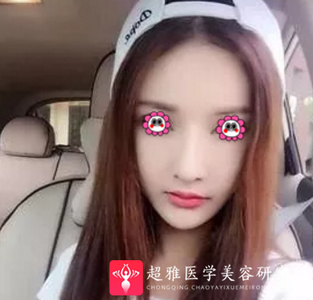 超级微拉美
