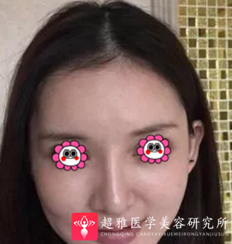 超级微拉美
