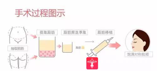 重庆超雅