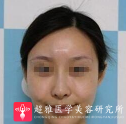 超级微拉美