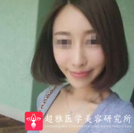 超级微拉美