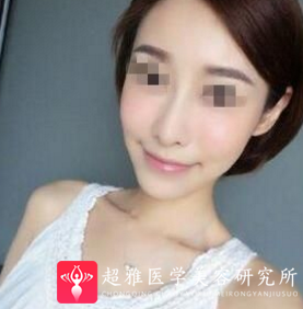 超级微拉美