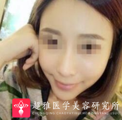 超级微拉美