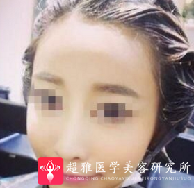 超级微拉美