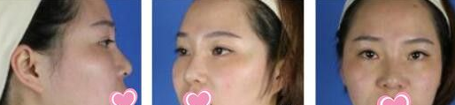 超级微拉美