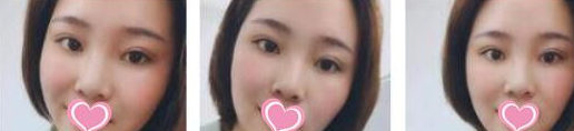 超级微拉美