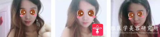 超级微拉美