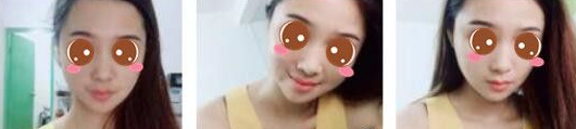 超级微拉美