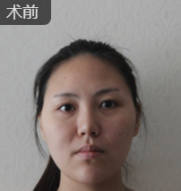 超级微拉美