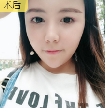 超级微拉美