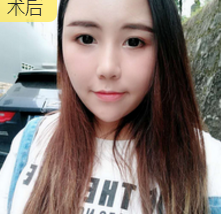 超级微拉美