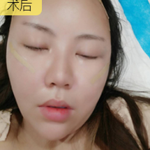 超级微拉美