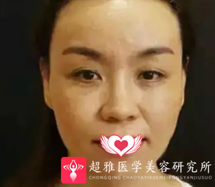 超级微拉美