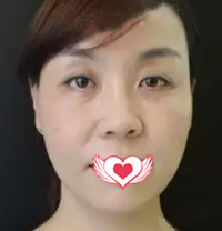 超级微拉美