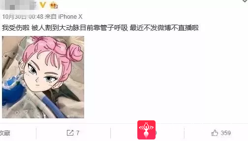 超声波瘦脸