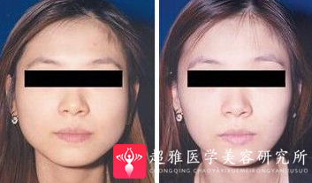 重庆超雅
