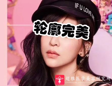 面部提升术
