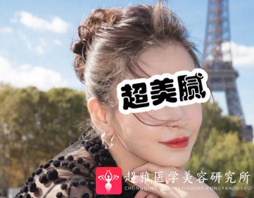 下巴延长术