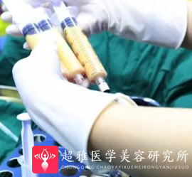 自体脂肪丰面