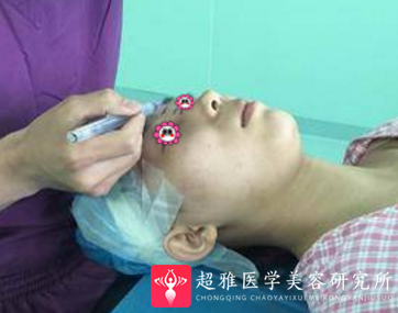 鼻综合整形术