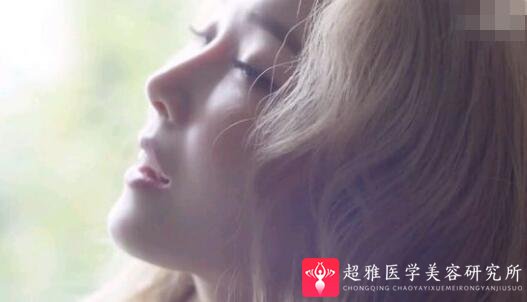 隆鼻手术